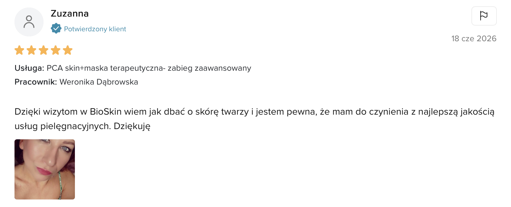 Opinia klientki BioSkin Ciechanów